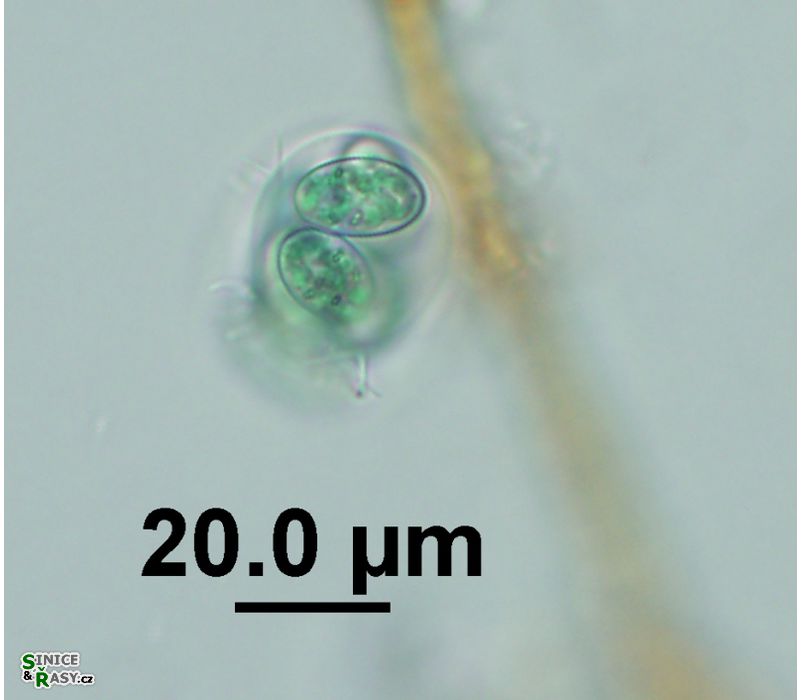 Glaucocystis nostochinearum