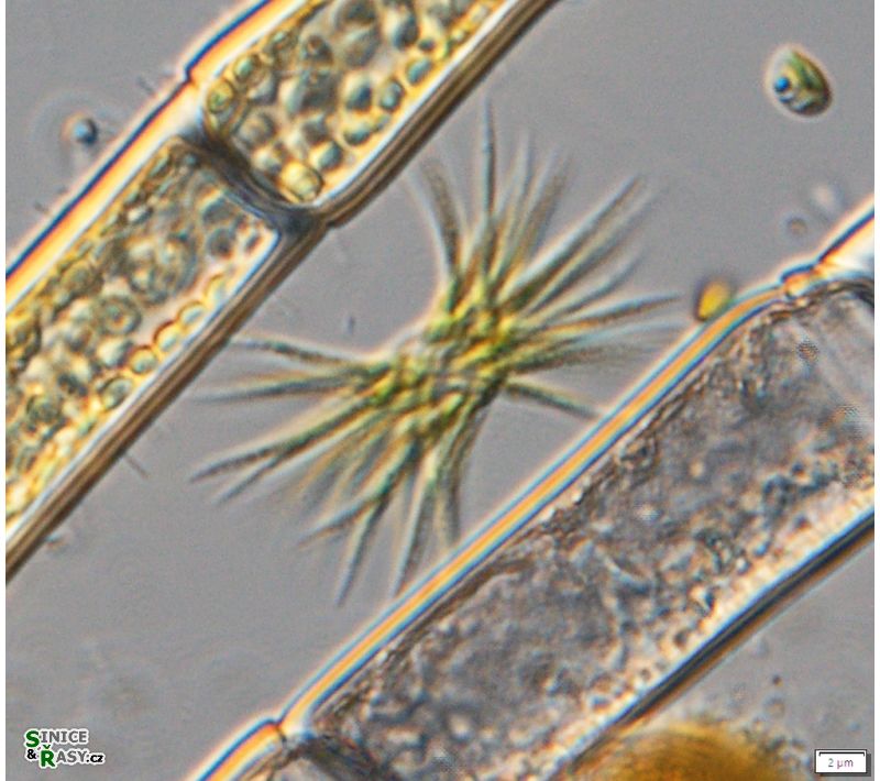 Ankistrodesmus falcatus