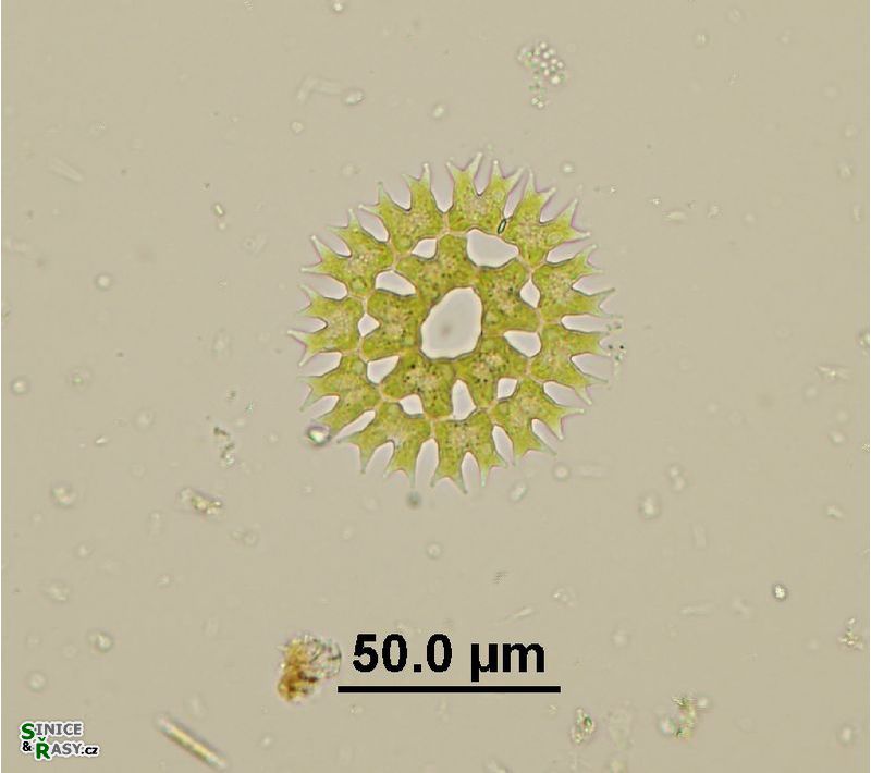 Parapediastrum biradiatum