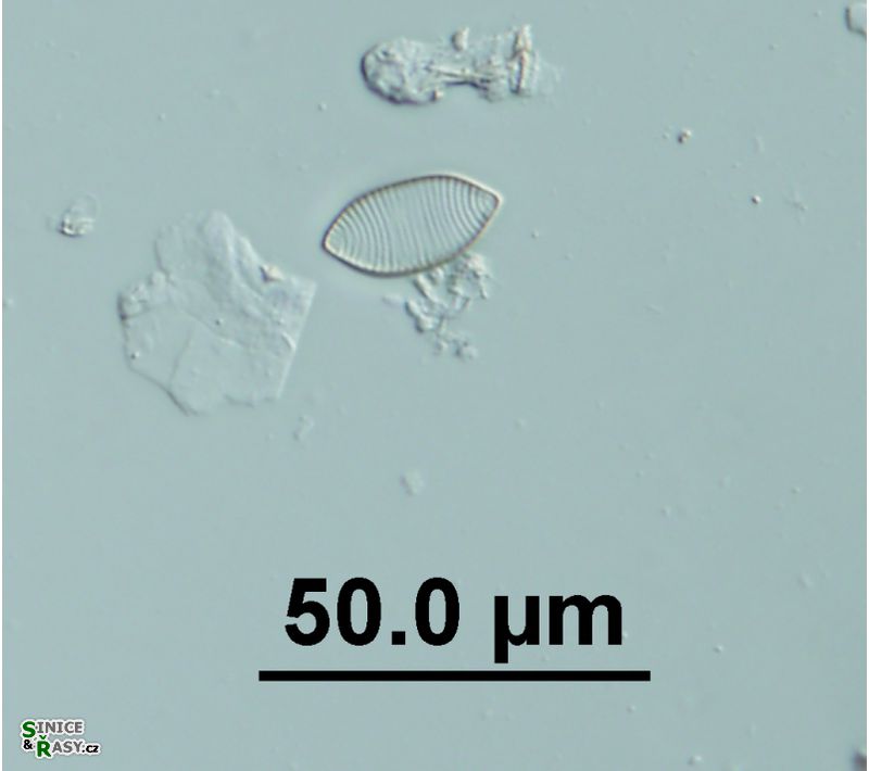 Nitzschia separanda