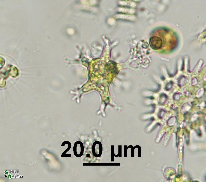 Pseudostaurastrum enorme