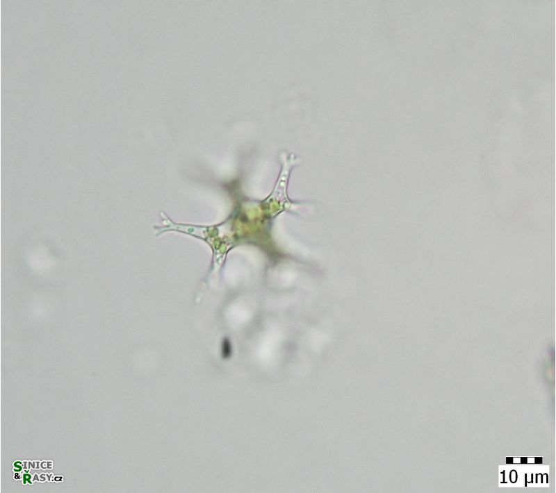 Pseudostaurastrum limneticum