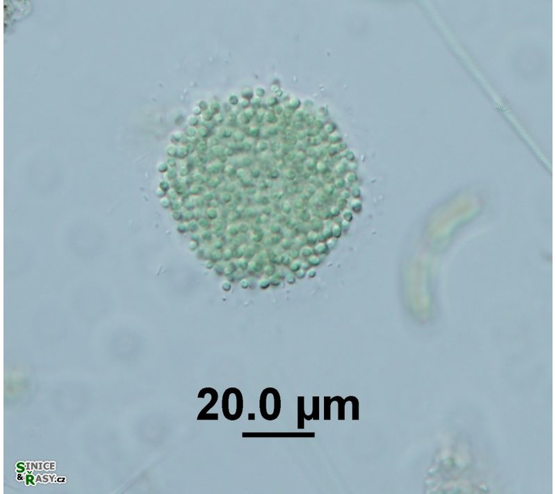 Aphanocapsa incerta