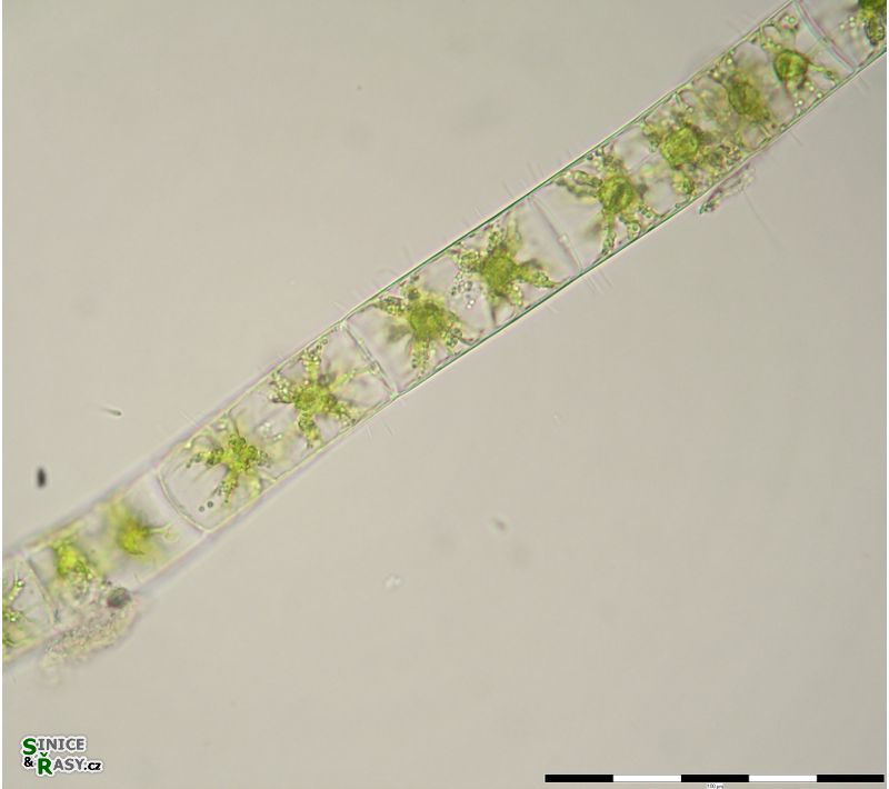 Zygnema
