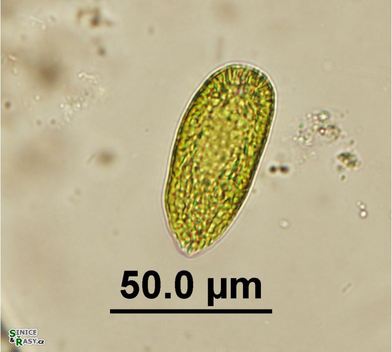 Gonyostomum semen