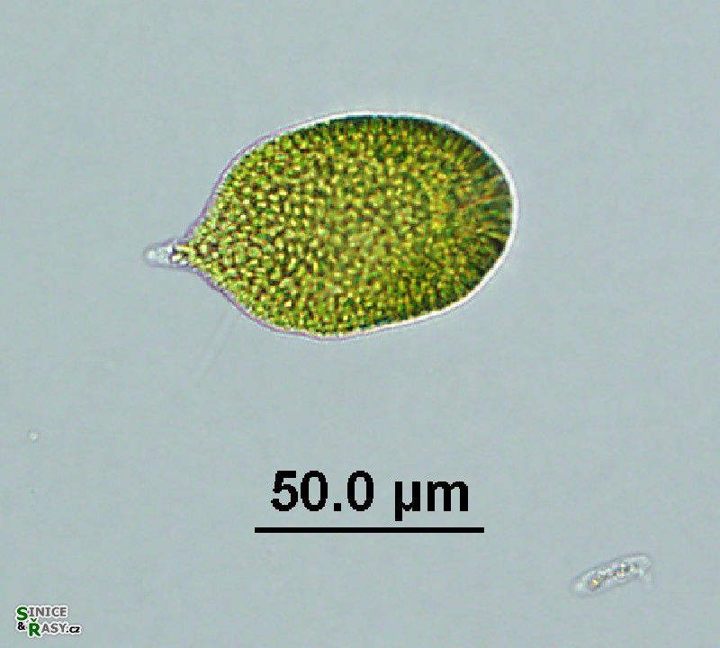 Gonyostomum sp.