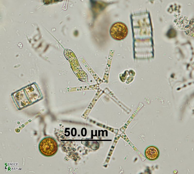 Ophiocytium capitatum