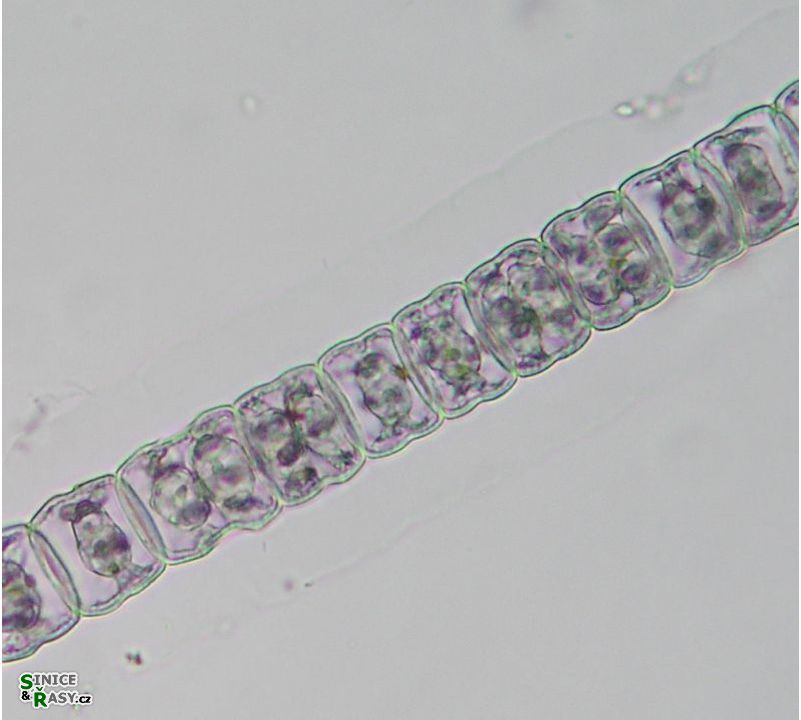 Hyalotheca dissiliens