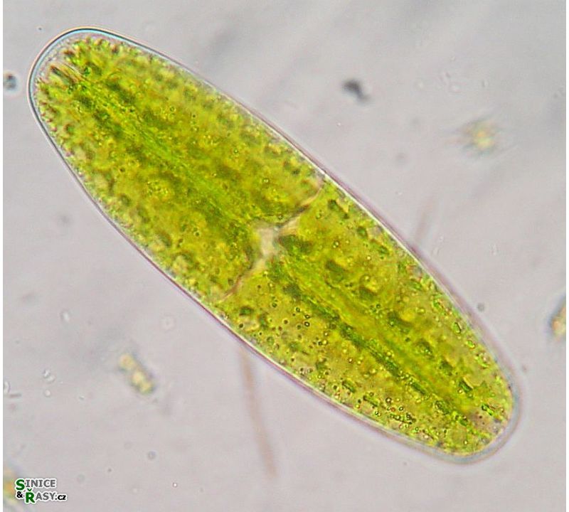 Netrium digitus
