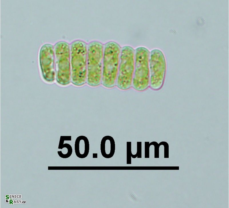 Scenedesmus ellipticus