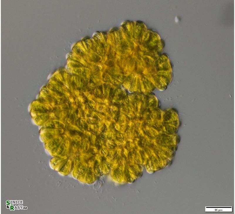 Botryococcus braunii