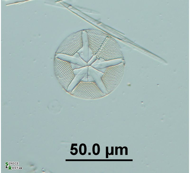 Asteromphalus robustus