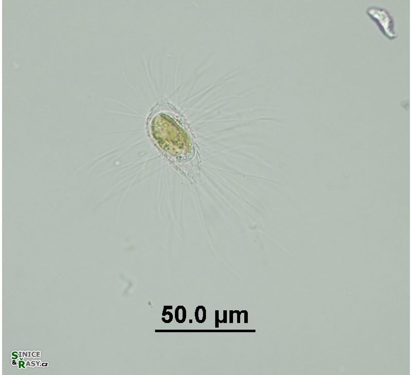 Mallomonas sp.