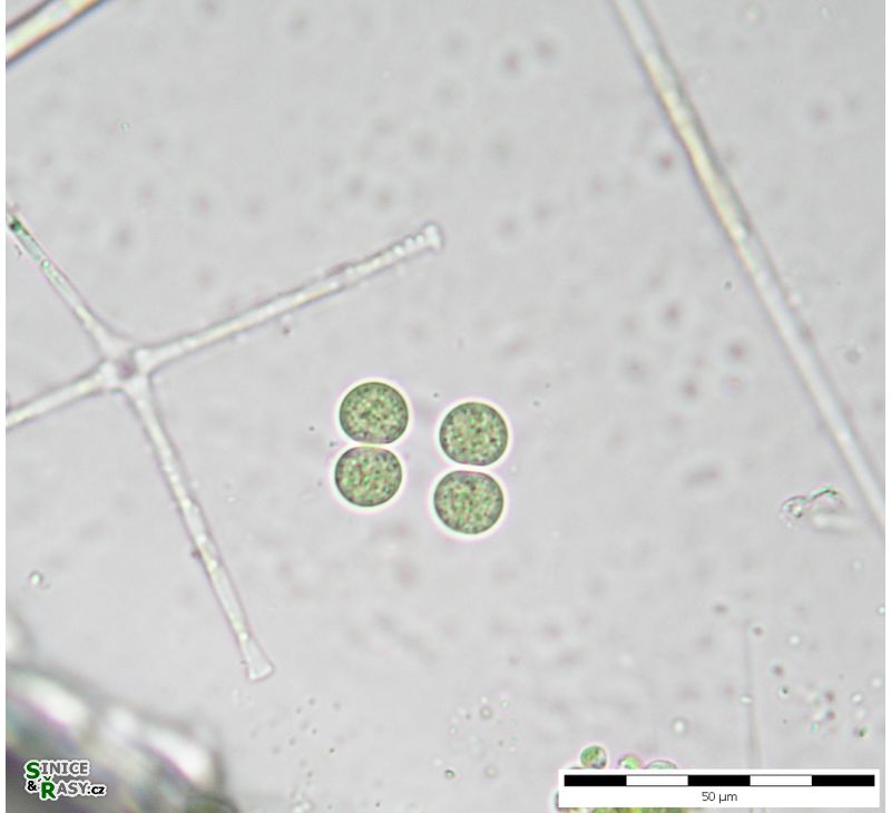 Chroococcus limneticus