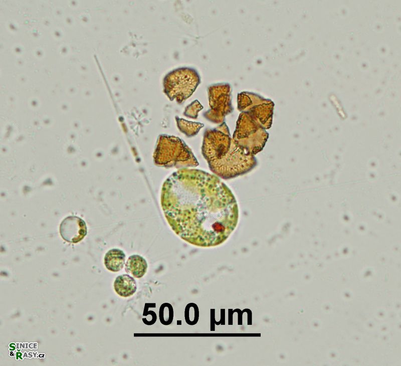 Trachelomonas