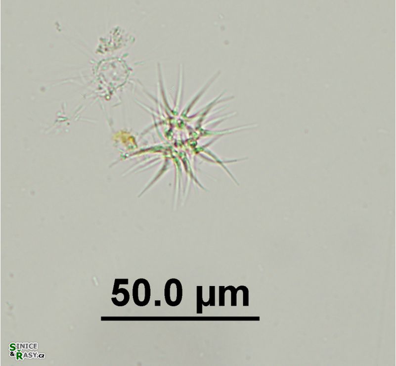 Ankistrodesmus gracilis