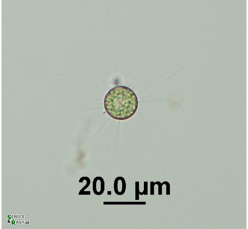 Golenkinia radiata