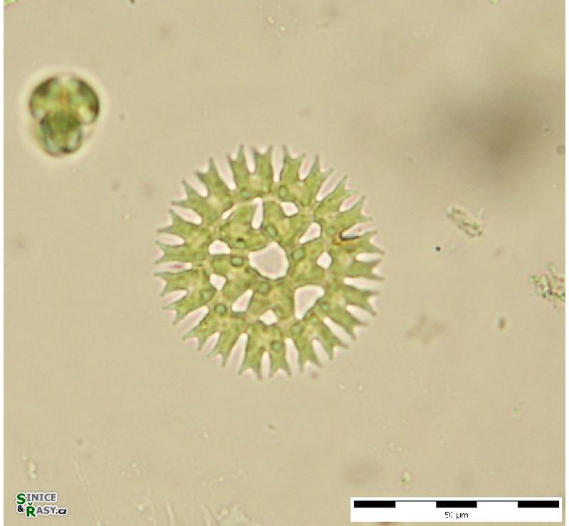 Parapediastrum biradiatum