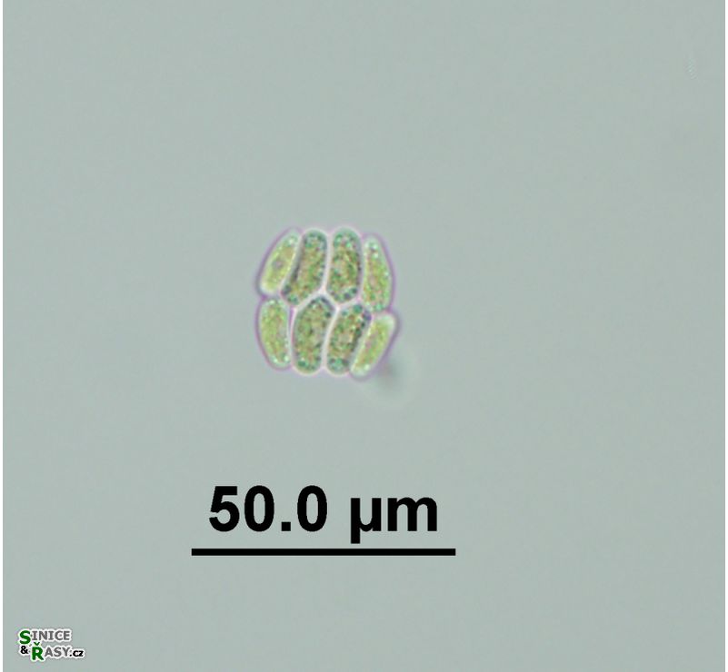 Scenedesmus obtusus var. disciformis