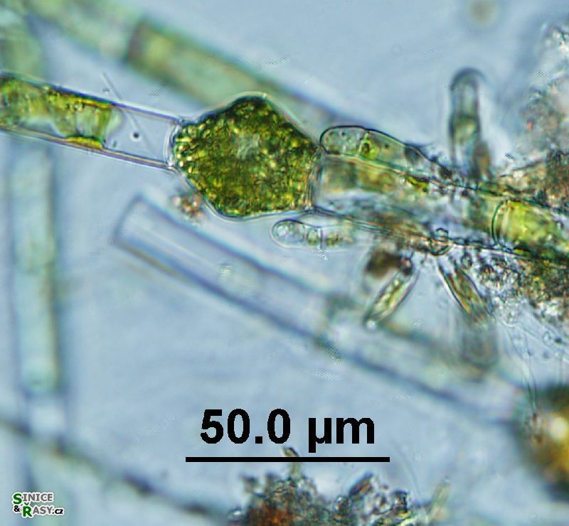 Oedogonium sexangulare