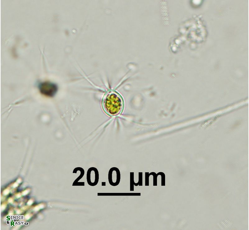 Lagerheimia longiseta