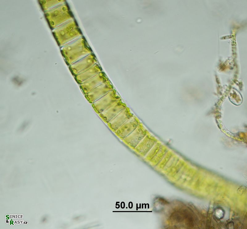 Ulothrix zonata