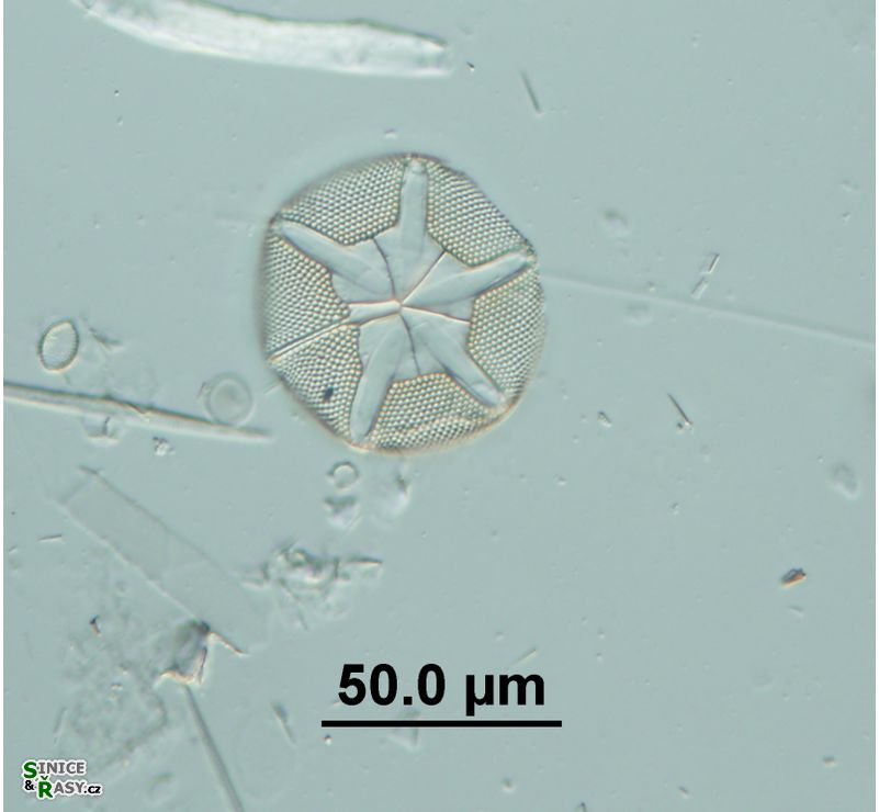 Asteromphalus robustus