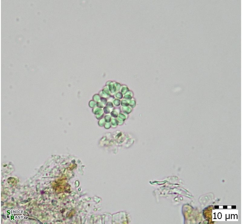 Woronichinia ruzickae