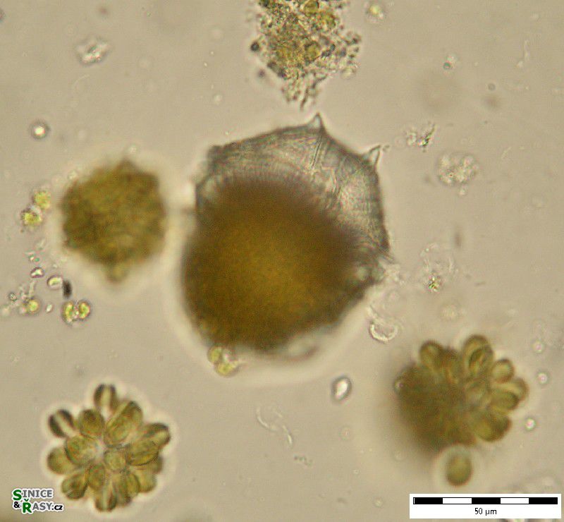 Parvodinium cf. umbonatum 
