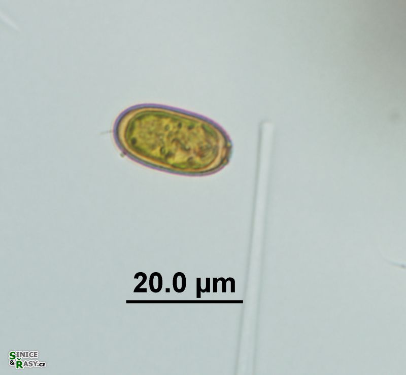 Trachelomonas abrupta