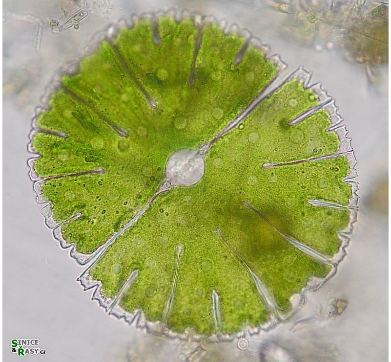 Micrasterias thomasiana