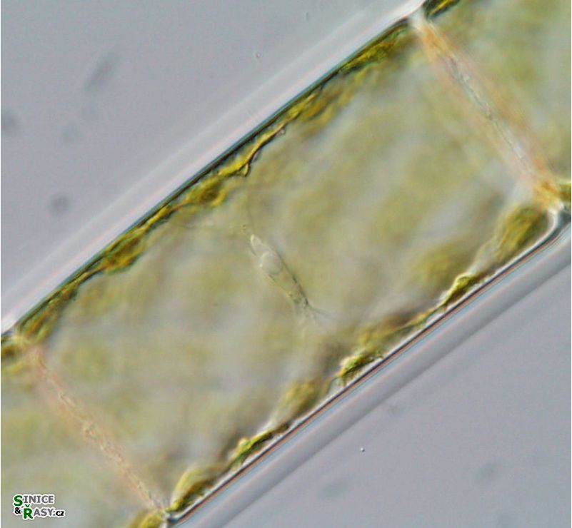 Spirogyra