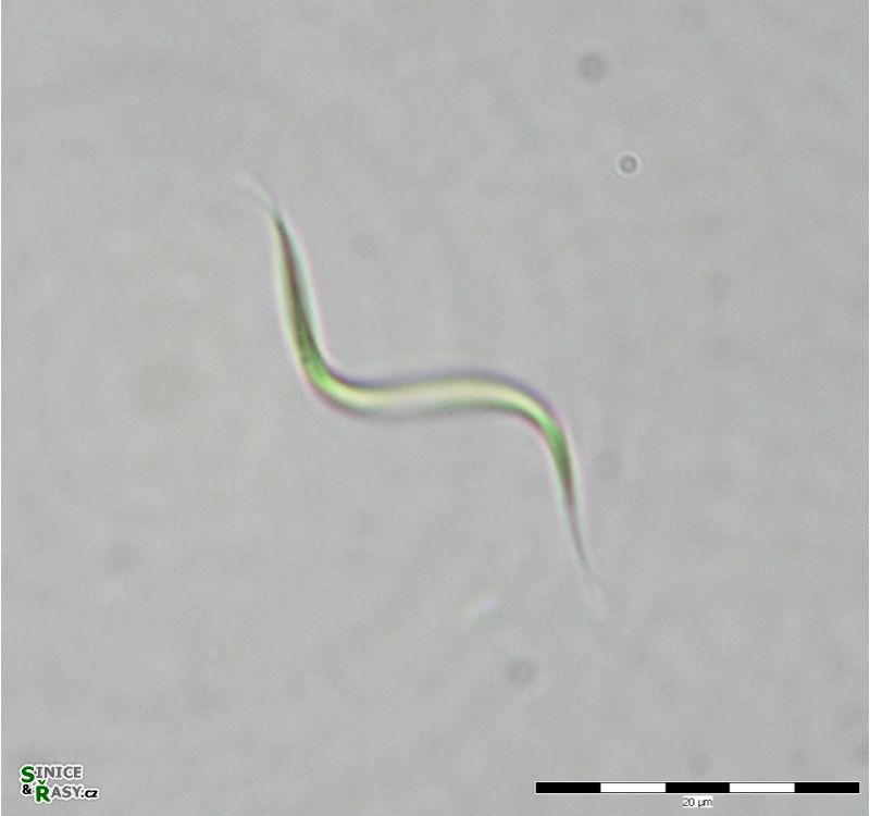Monoraphidium contortum