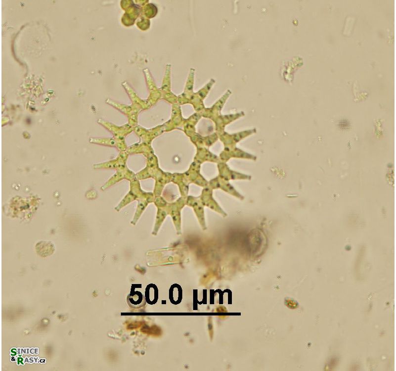 Lacunastrum gracillimum