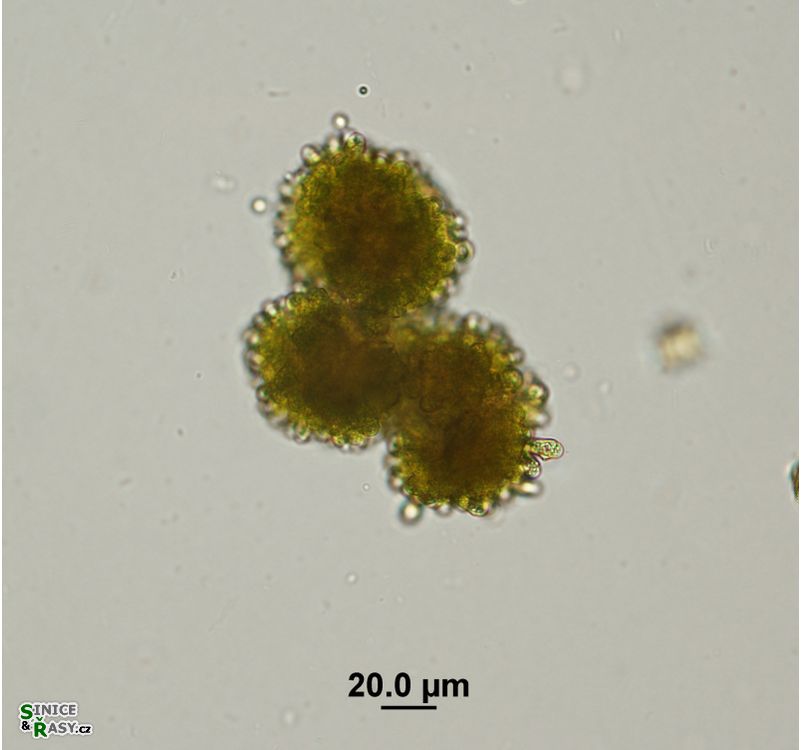 Botryococcus braunii