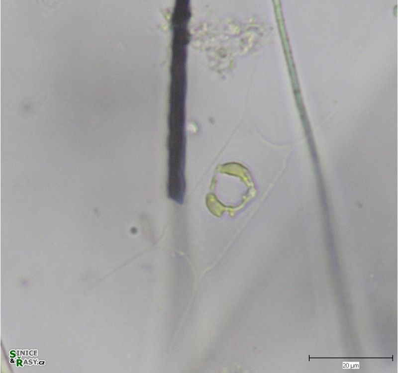 Acanthoceras zachariasii