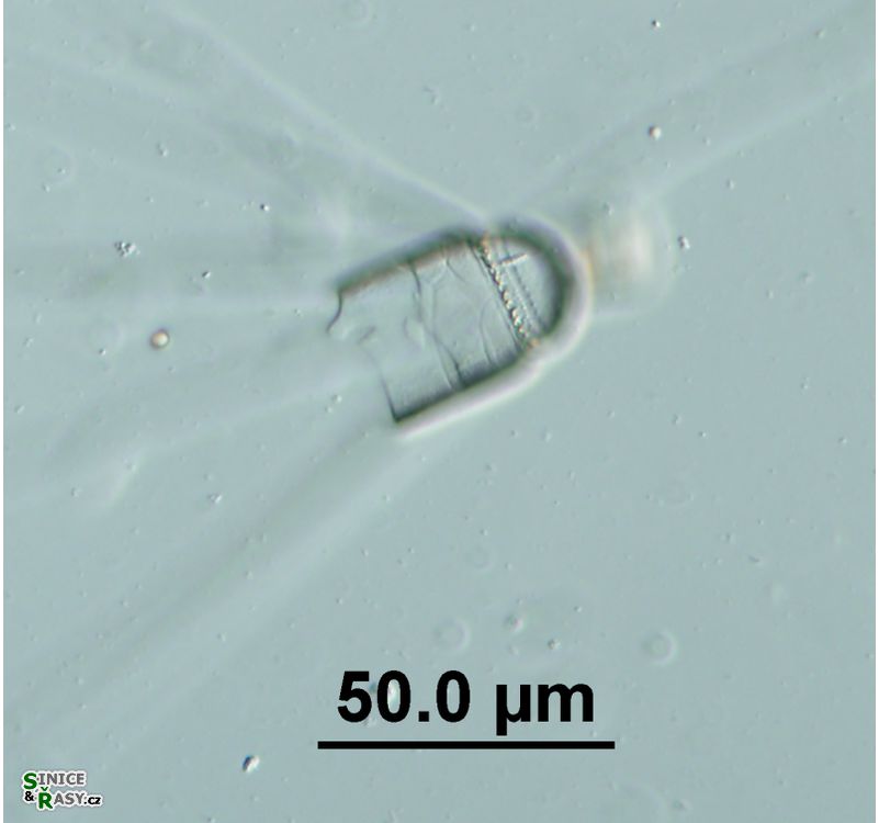 Corethron hystrix