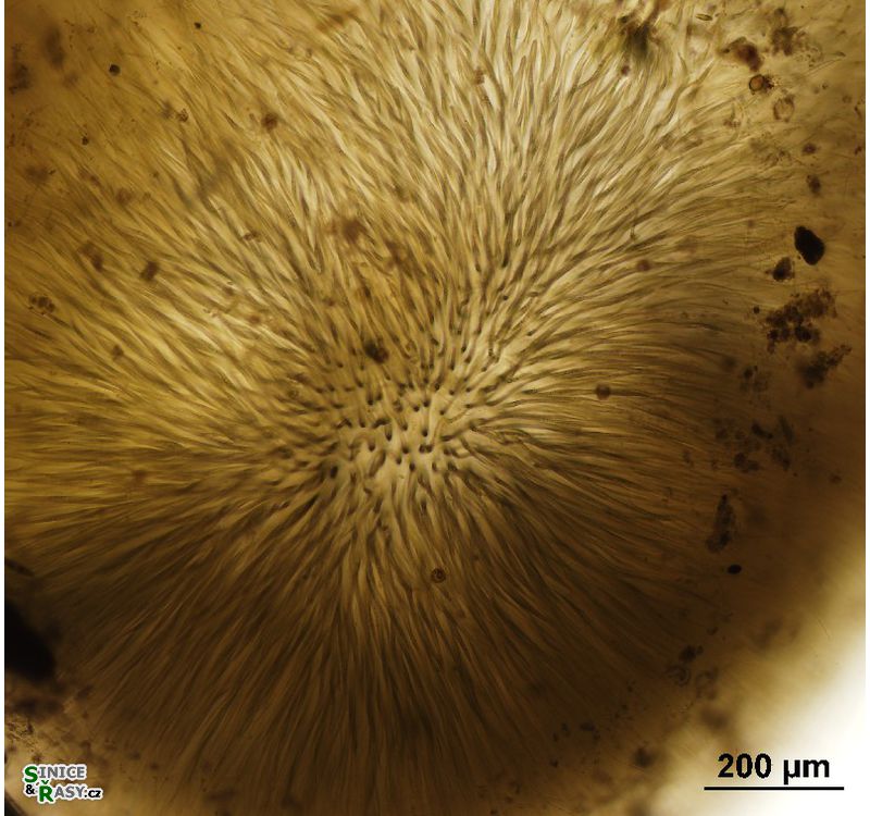 Gloeotrichia sp.