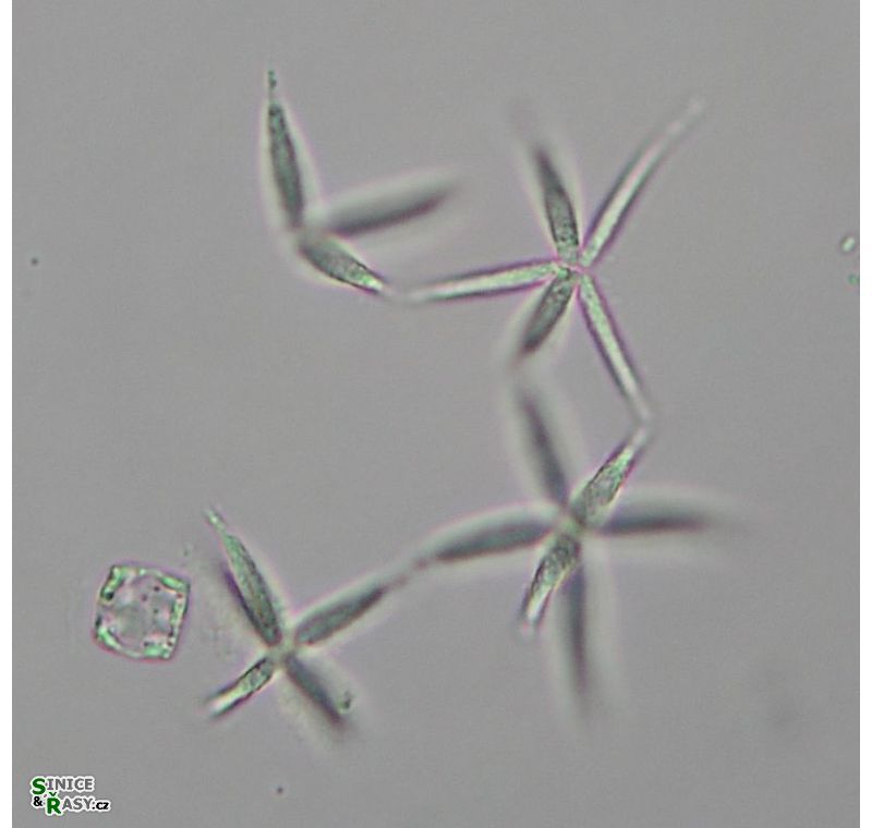 Actinastrum cf. fluviatile