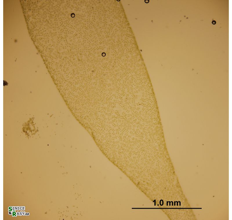 Tetraspora gelatinosa