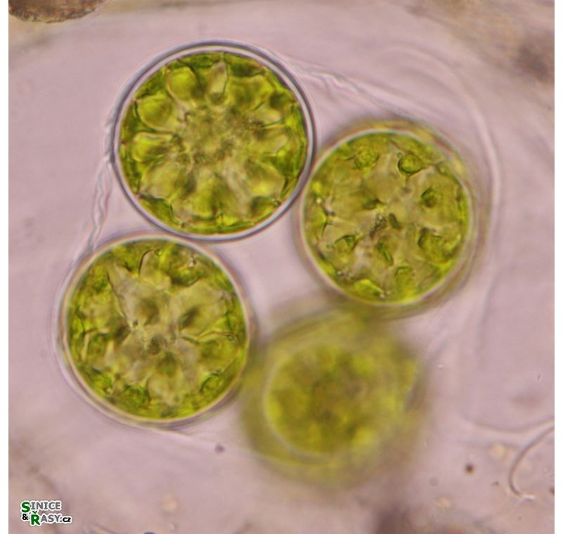 Asterococcus superbus