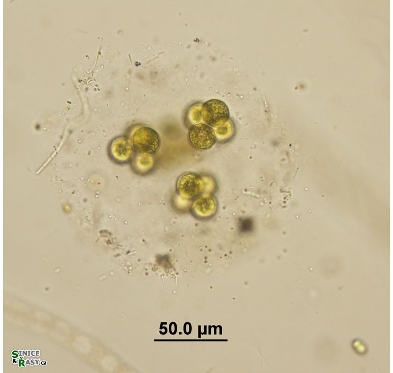 Botryosphaerella sudetica