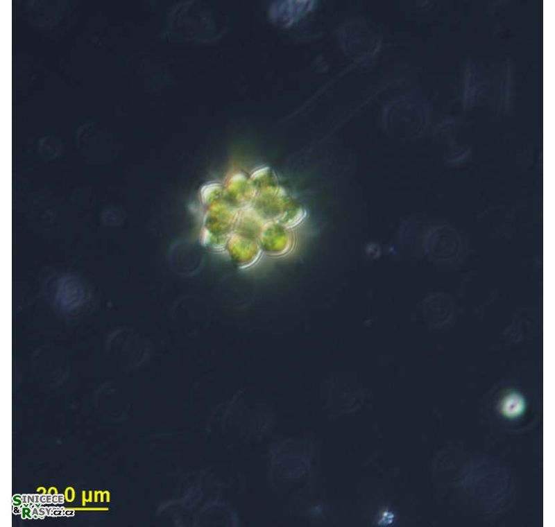 Coelastrum astroideum