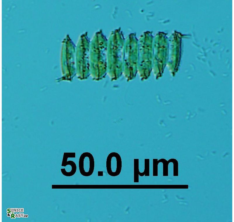 Desmodesmus praetervisus