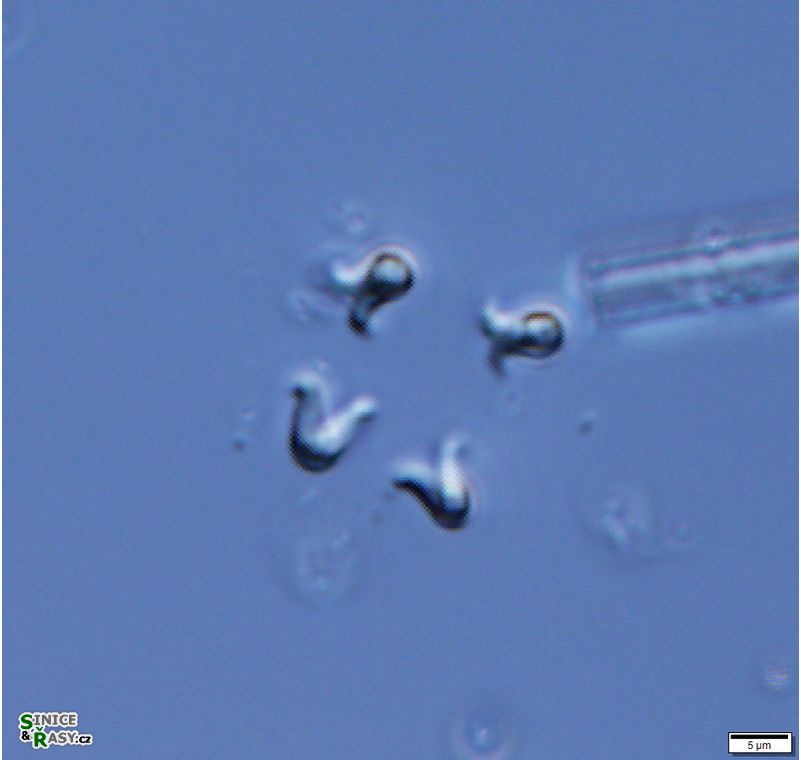 Kirchneriella irregularis