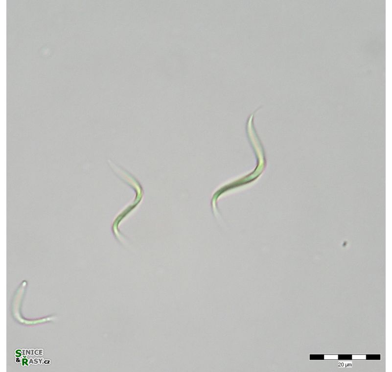 Monoraphidium contortum