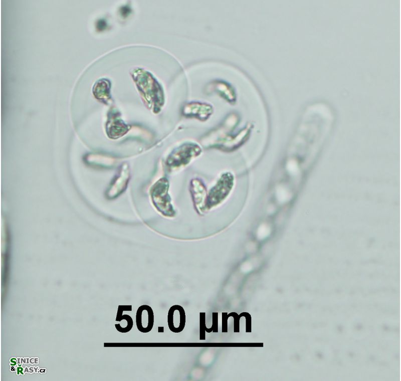 Nephrocytium limneticum