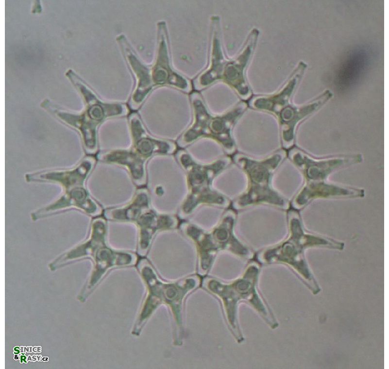 Lacunastrum gracillimum