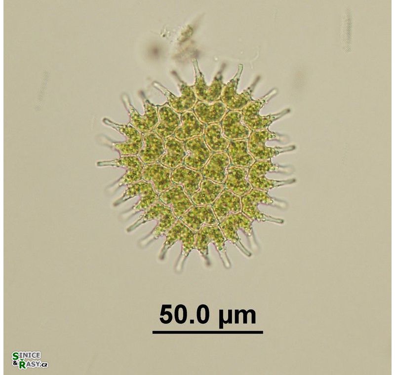 Pseudopediastrum boryanum var. longicorne