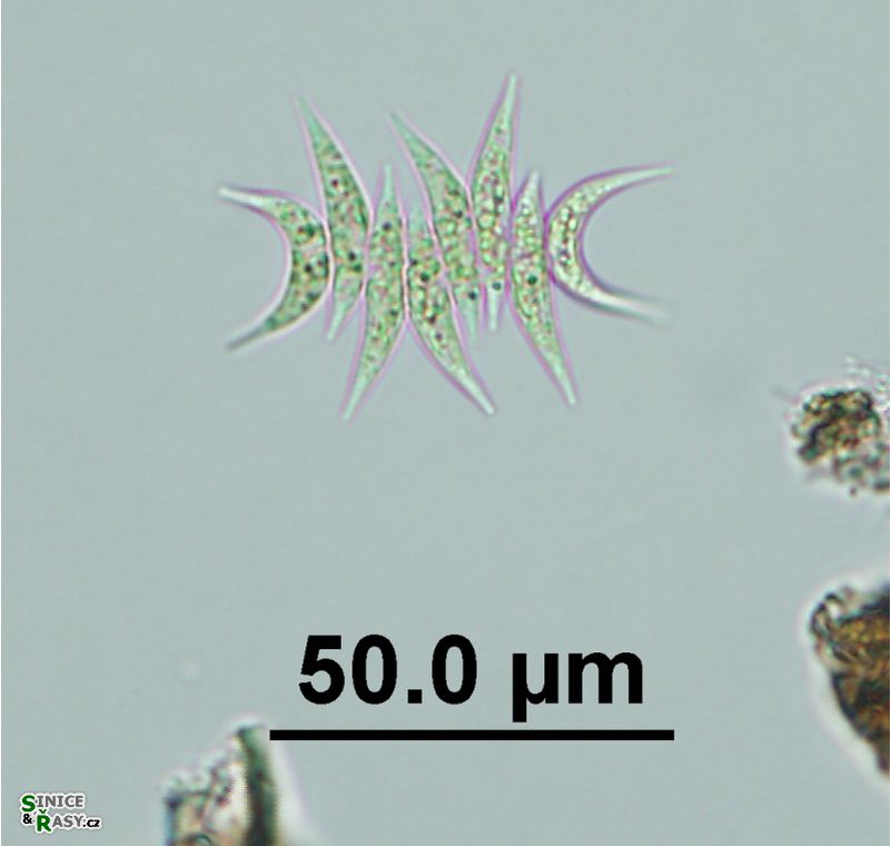 Tetradesmus lagerheimii